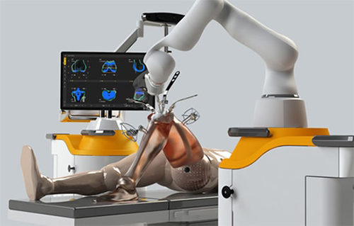 What is Robotic Knee Replacement