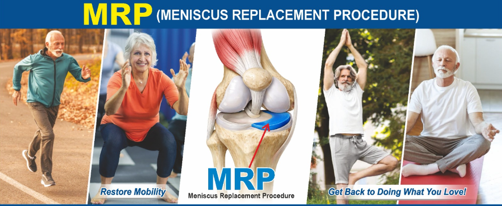 Meniscus Replacement Procedure (MRP) — patients running, squatting, doing yoga and sitting cross-legged after restoring knee mobility
