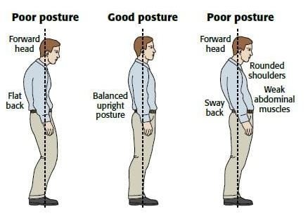 Common Posture Problems