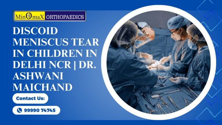 Discoid Meniscus Tear in Children in Delhi NCR