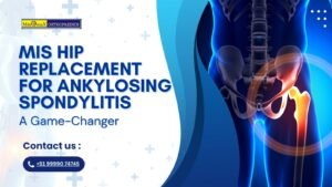 MIS Hip Replacement for Ankylosing Spondylitis
