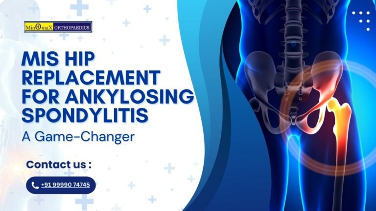 MIS Hip Replacement for Ankylosing Spondylitis